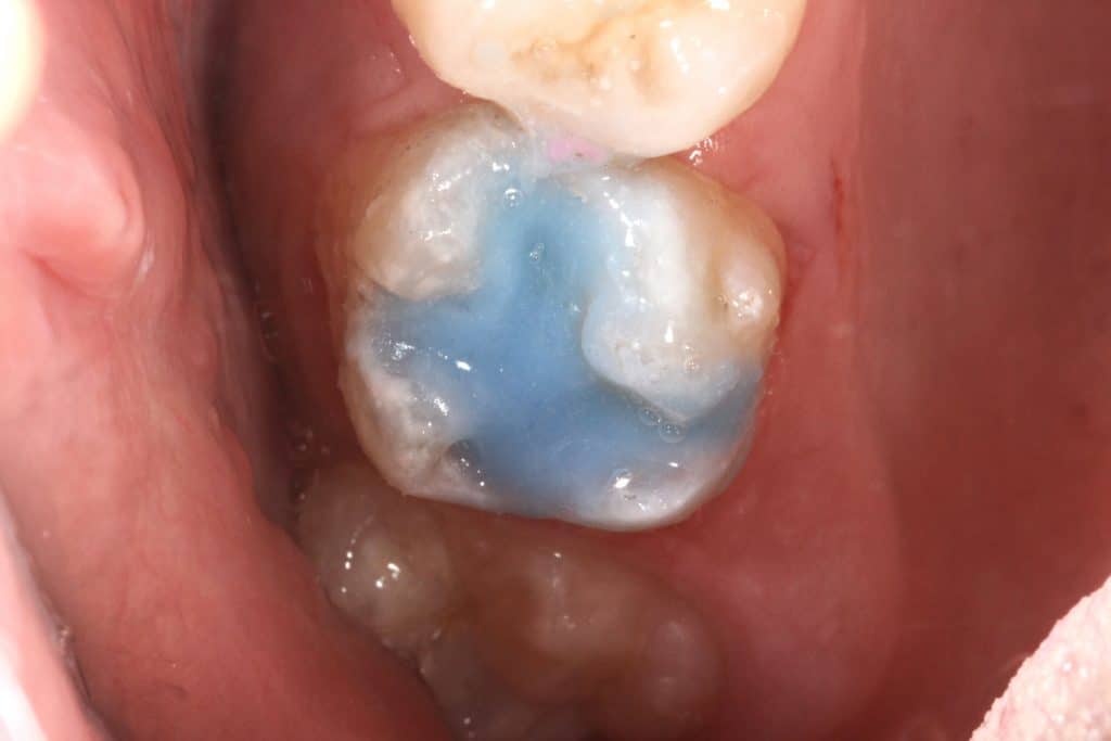 23C9E422-9803-4FC7-88FE-FDCE48F2F4BA