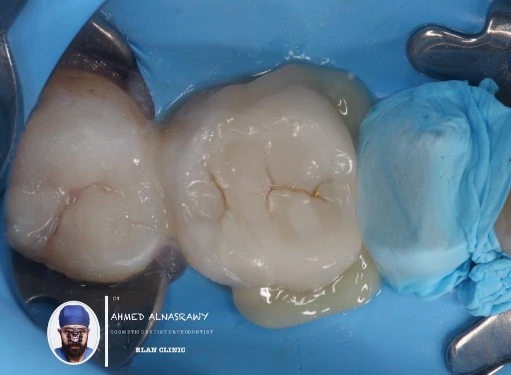 26095DCC-6BC9-4593-BD99-9327275C33DB