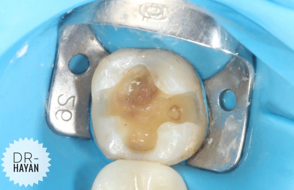 2A348ABB-6658-4CBC-9C55-738DE91713FF