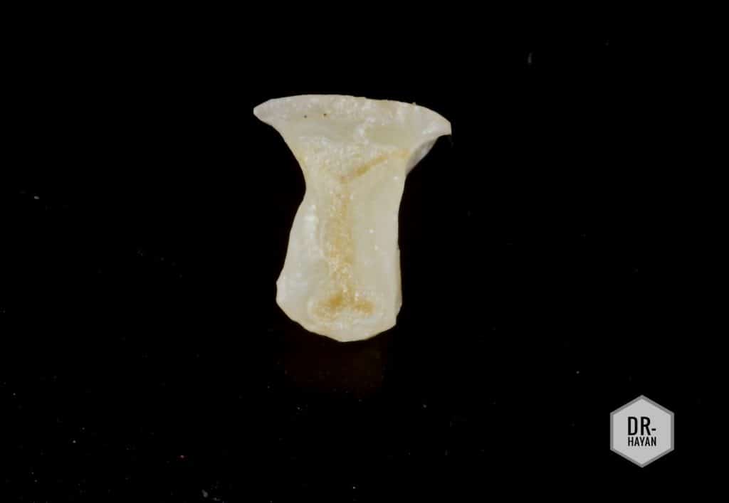 3010FAD5-510F-42C9-9FFC-DFD66795D615