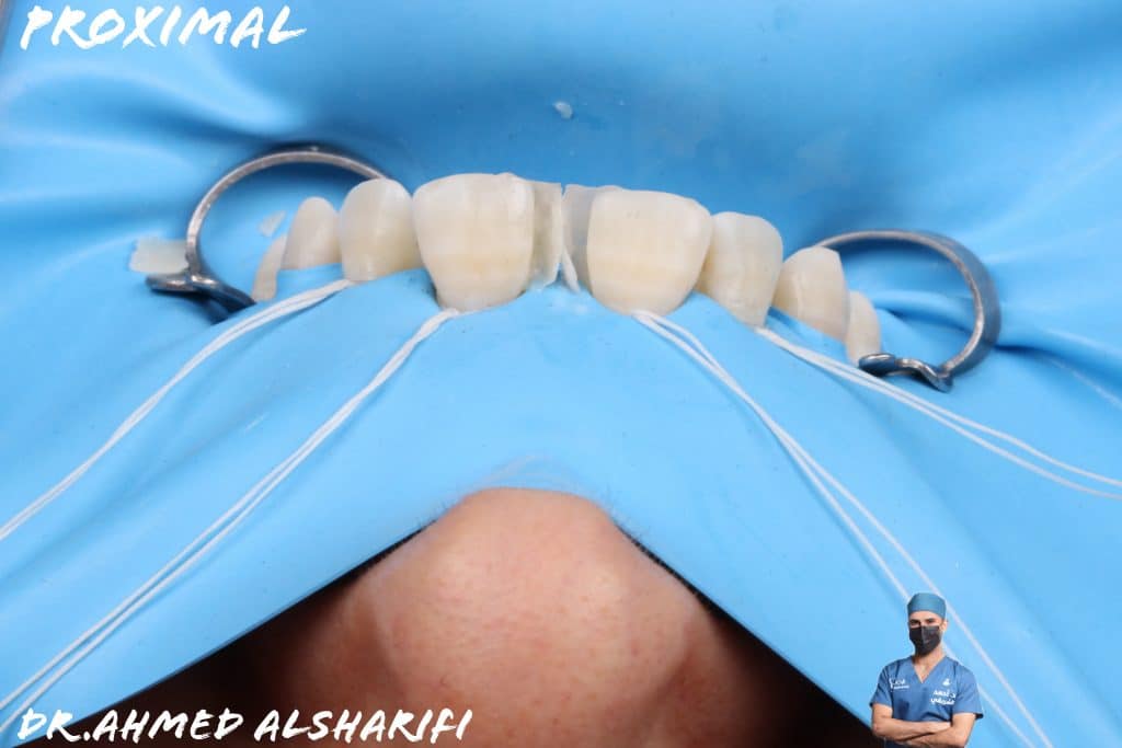 36B217CD-211F-4228-9CE4-26039113C8D9