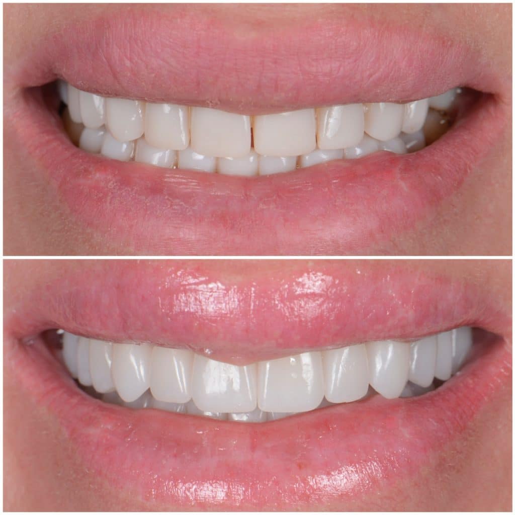 380F359E-D1A1-46AC-98F5-30C19EF780A2