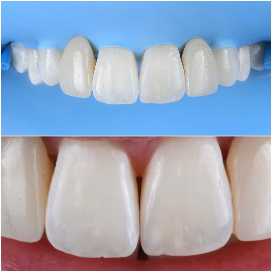 3BA914DB-ABD3-47ED-BE60-0AAE0838B2FB