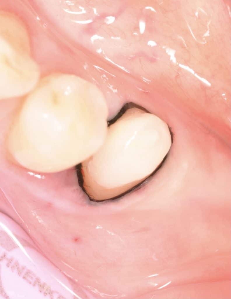 3C5AB3E8-A69D-419A-98A3-5E8D04DE6559