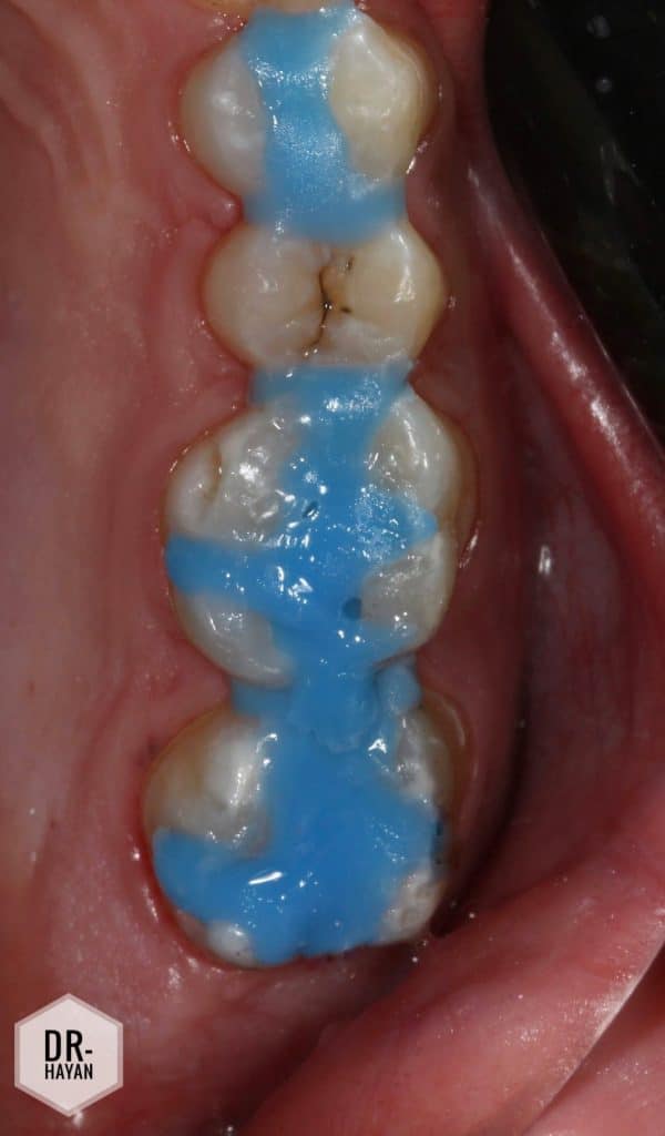 3D05FBFD-1071-4327-BE38-28BBF8B64215