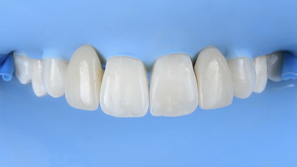 44AE2D0C-535D-4F5A-A2F2-E2392D87F37C