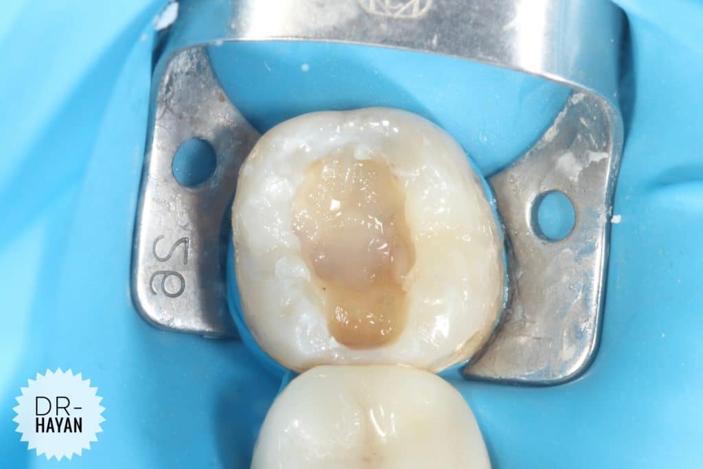 47FA3016-60D6-4CBB-B26C-2352965BC961