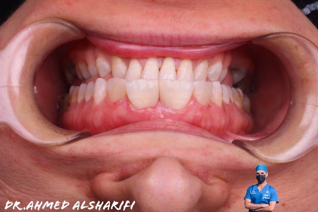 480DEAF2-5EEF-47E9-824D-8EE4CFE2A3E2