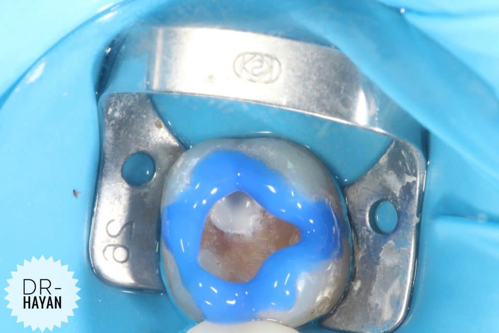 4B6C15E7-7FF6-4AA2-A186-20D2E81F3445