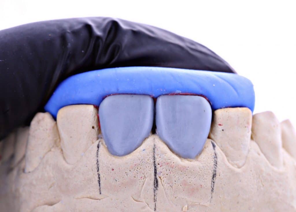 4EF6AE28-AD24-440E-9181-3A5D0550D74A