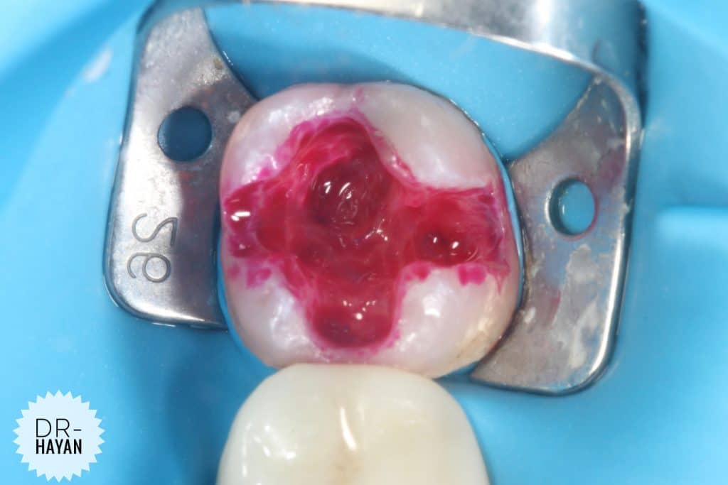 51692D59-D753-4CEE-8825-899E1B7D6024