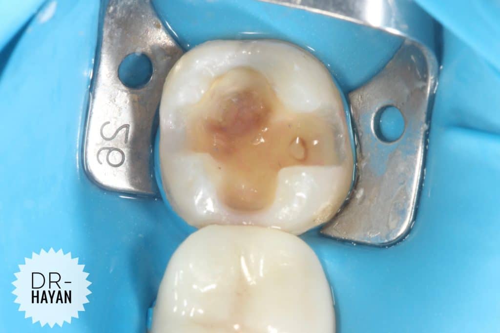 5666395C-F86B-4955-AC40-C0B0AB6DBC9D