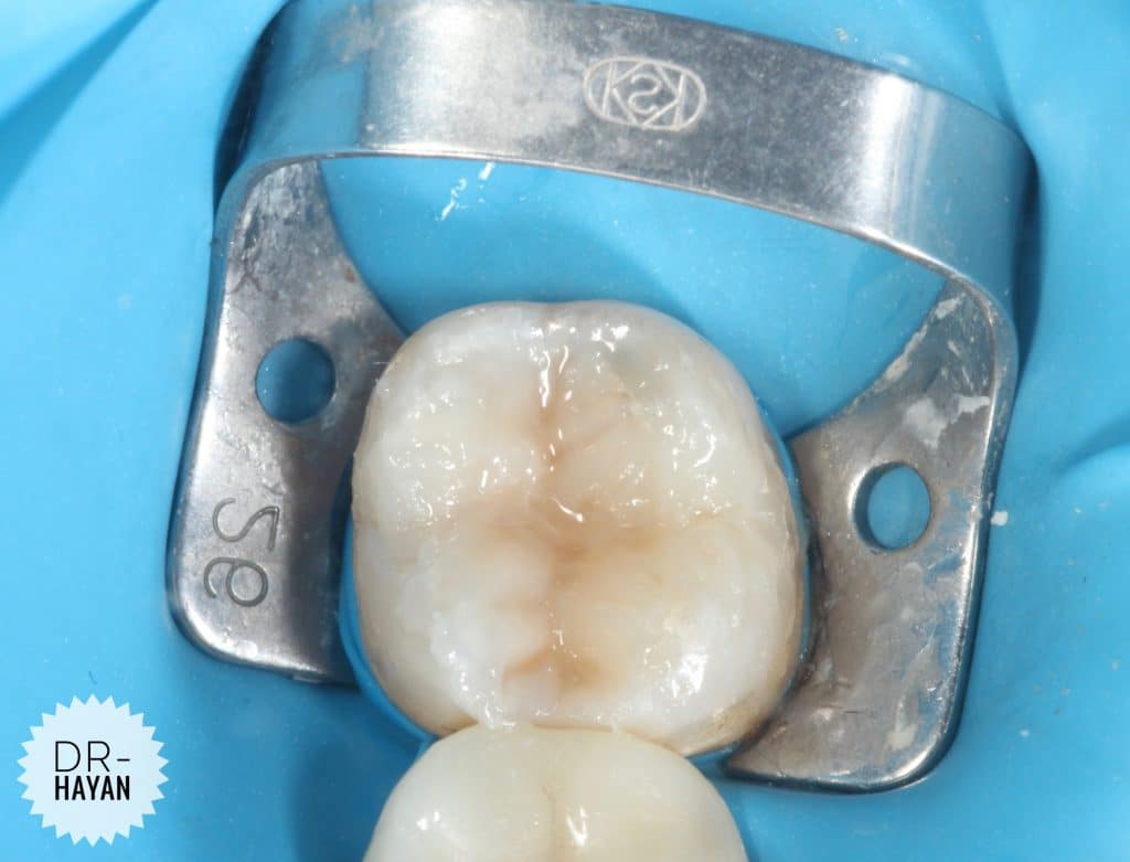 5A12E64F-4360-4A5D-A744-905981F2B942