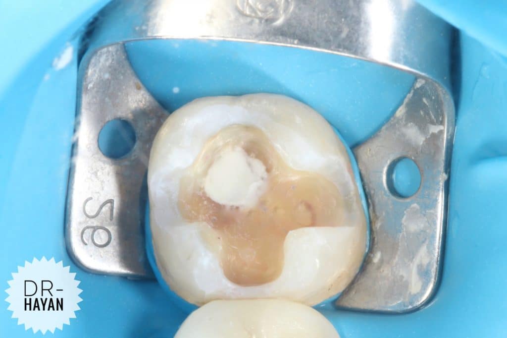 5FA0D347-07E5-4913-93D6-F6290CF1420E