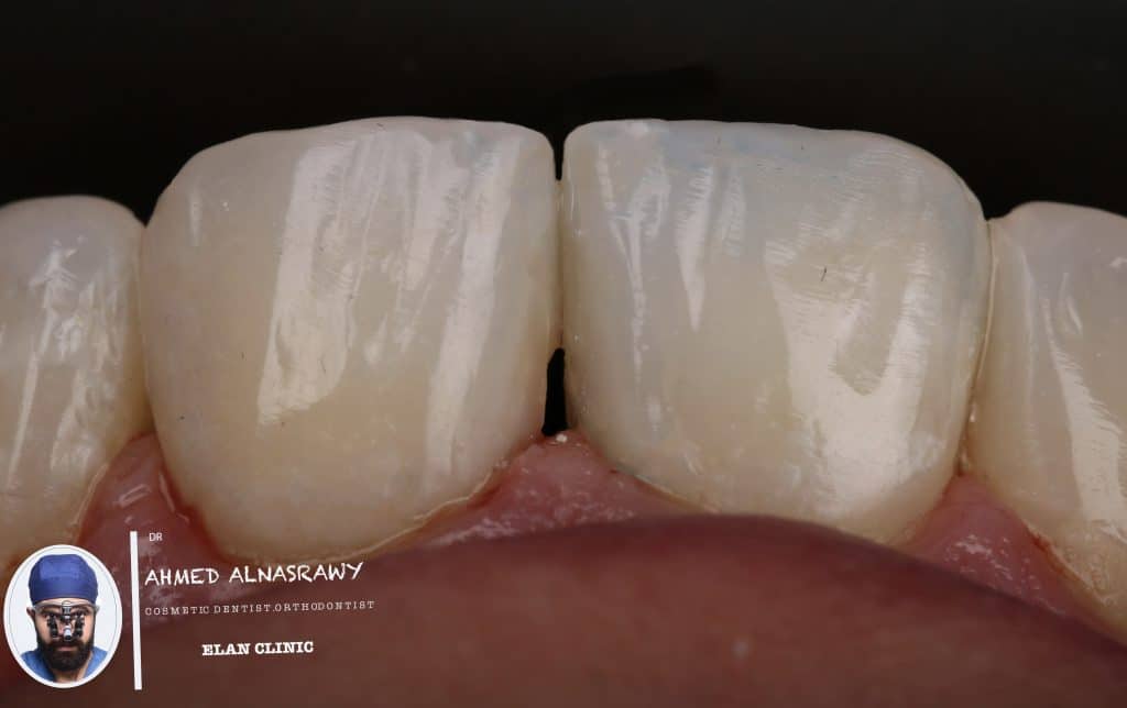 648EDE60-CFFE-4213-87D7-86AD29CADA57