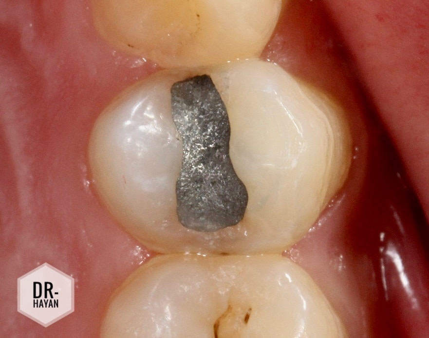 6741065D-642D-4A60-93BE-ABAE6A49B821