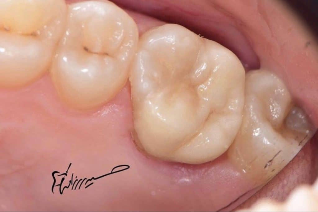 79392B51-84DF-4222-9BD8-06A00FB43318