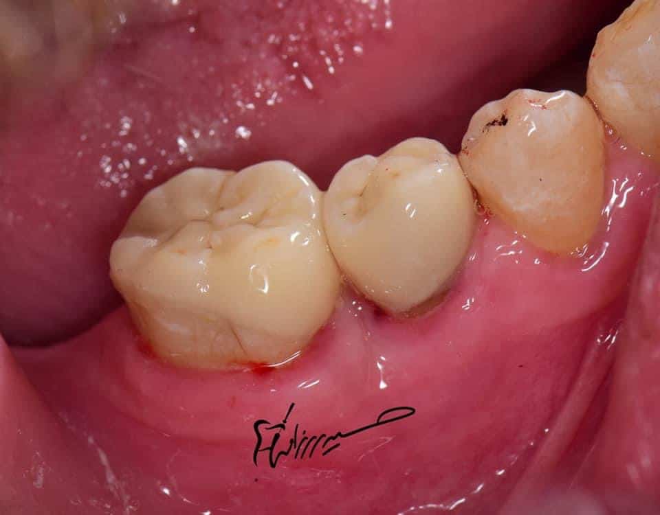 7D128576-3FB3-4D73-841D-8EFC307BA682