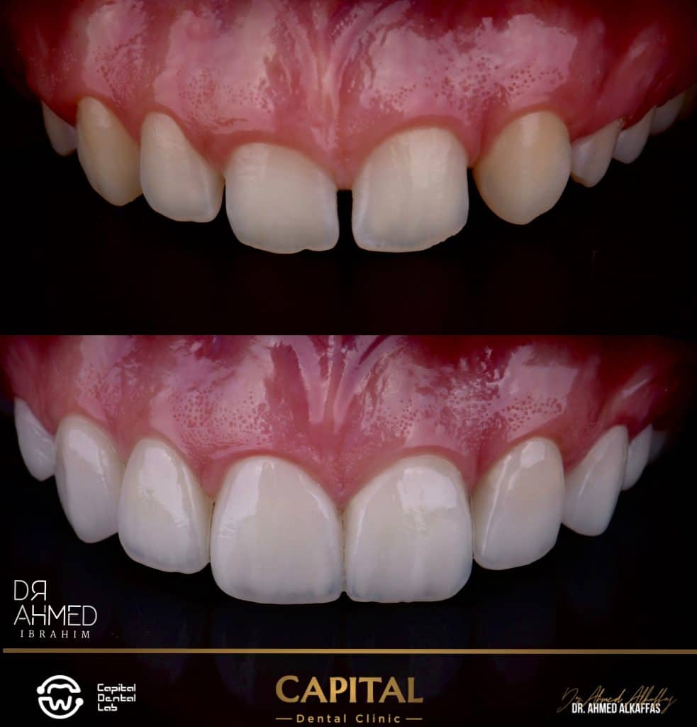 Initial situation vs final results