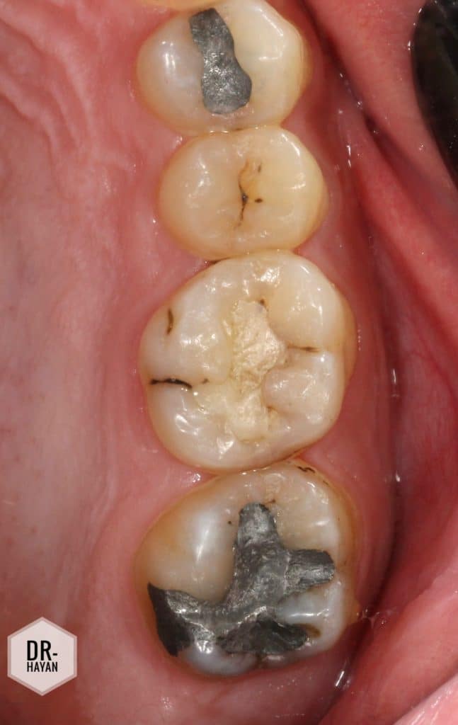 82C0EEA9-4BC9-4858-A319-1964BE01A94C