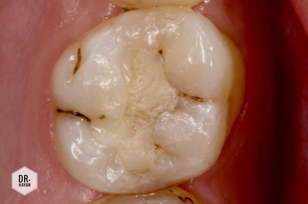 847C3B29-BD90-488B-9B53-F41843BBF4E9