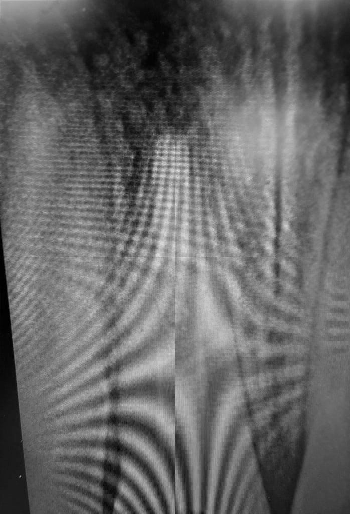 86AF4E42-41D9-4981-922B-FB75020CFF5E