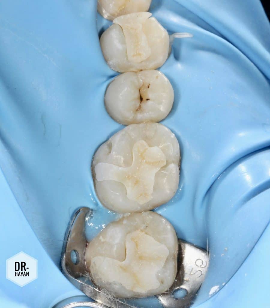 894A5609-5AC8-4251-813F-A8CFE519F136