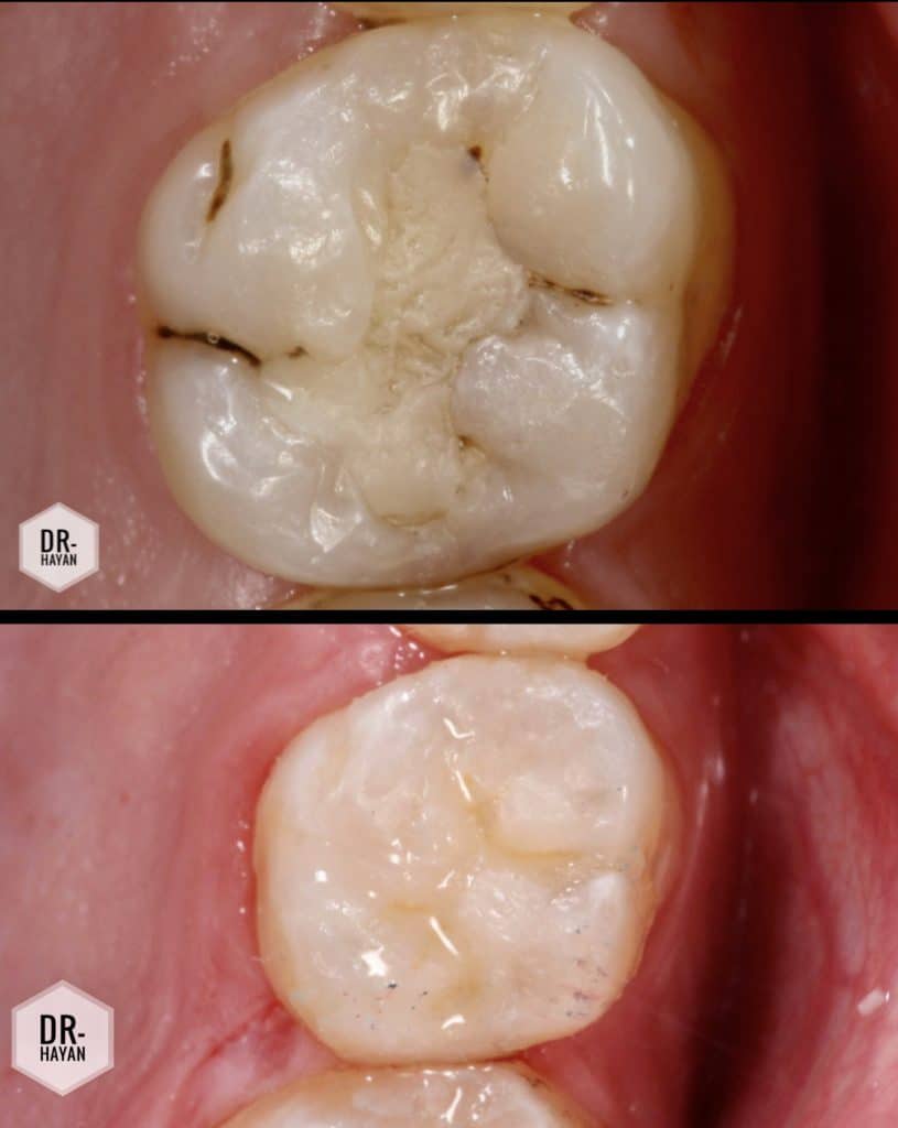 8A8108D4-7EA8-42F0-A81C-AB9478277FDF