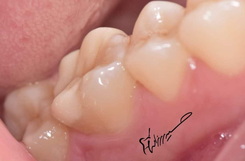 8ED74246-DED5-4263-8E64-3B0EEBF66B7F