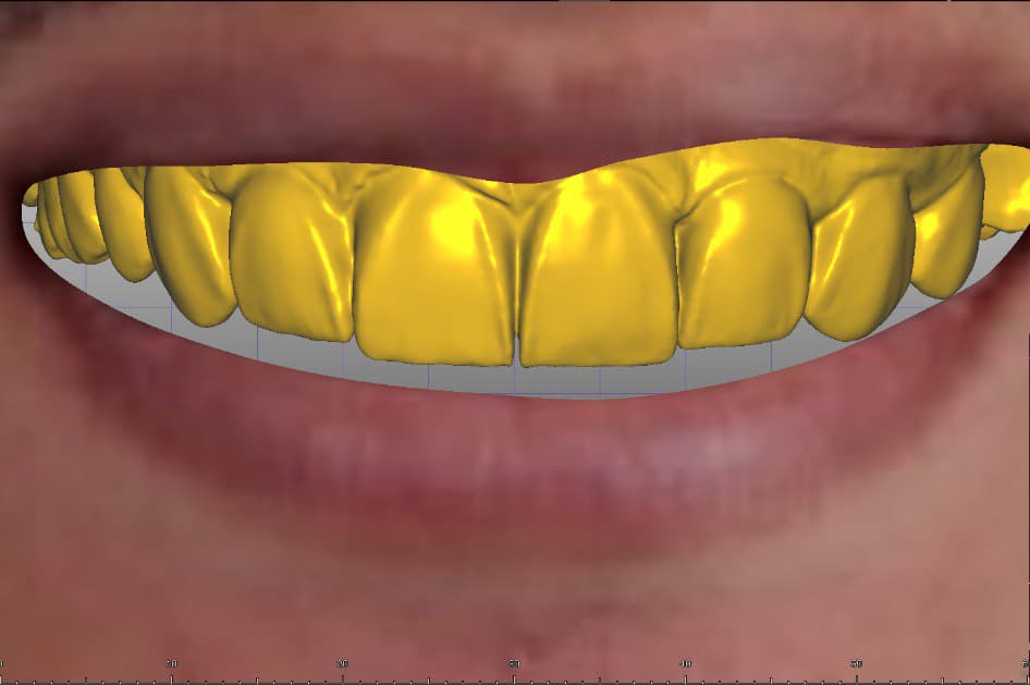 9-5418290923000936584_121