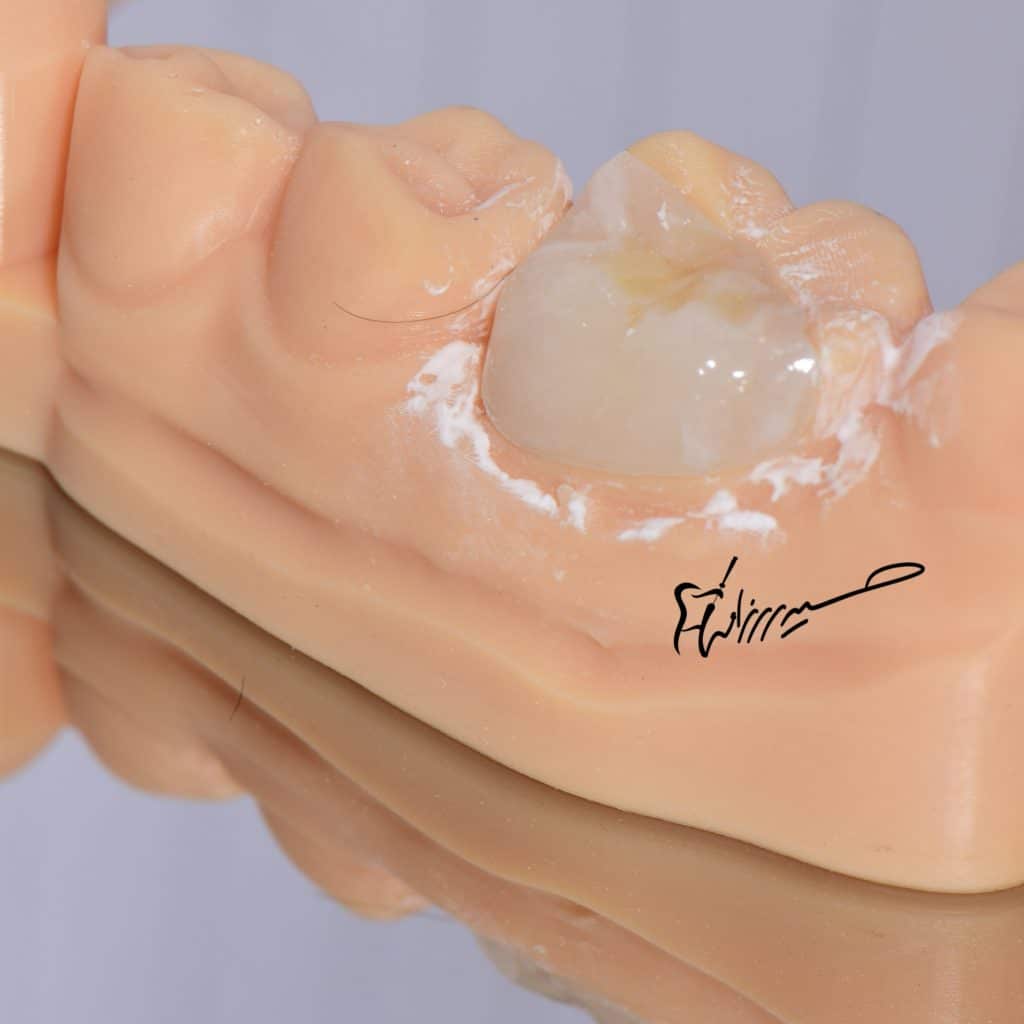 931D0D57-3B63-4BEC-9A80-B962C1E56CFE