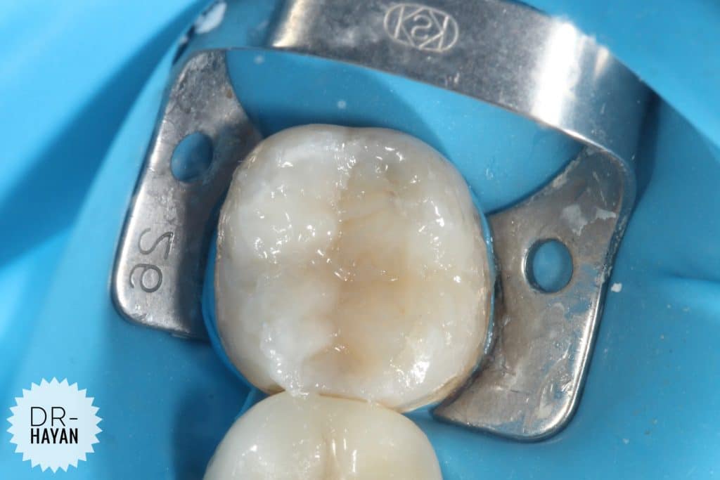 9A942327-8987-4244-88D0-FF220118AEF6