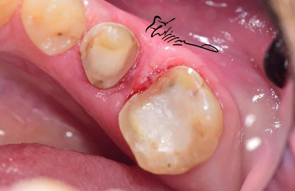 9E18DC40-01FE-47ED-8971-40938B387207