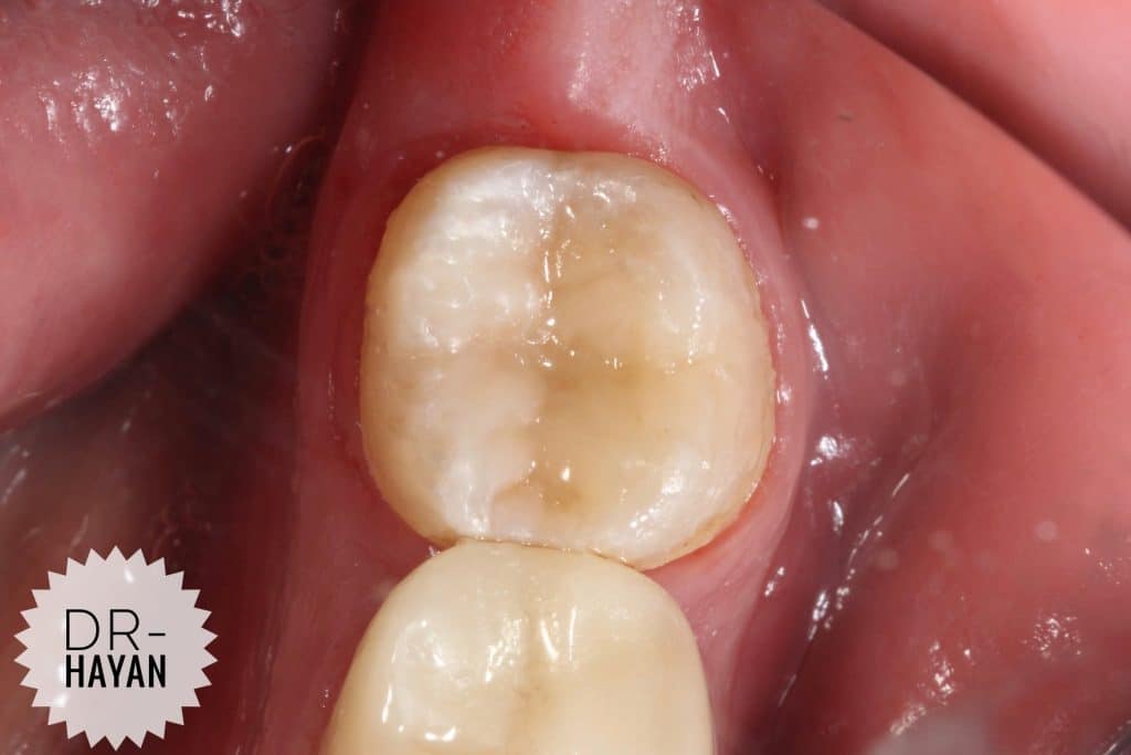 A3C8FD1F-C11E-419B-BB93-A9B4B2F8DF2F