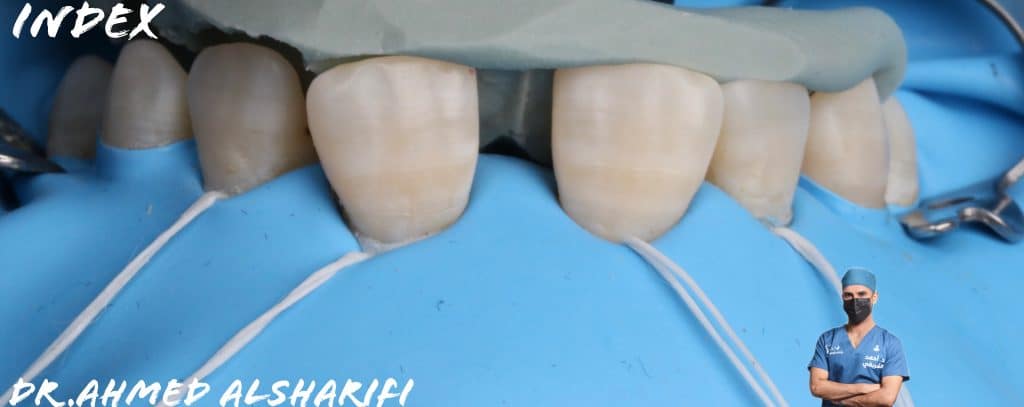 A3D65415-016E-4BEC-A536-BF59C3AAC164