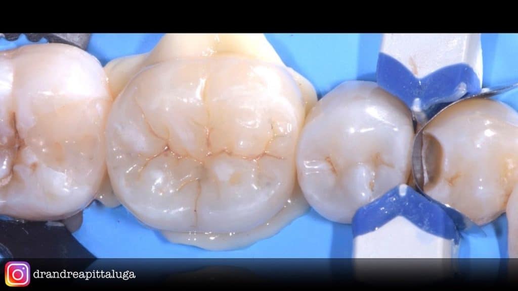 A4EA2D77-E8EE-405E-B3D8-93D77F347319