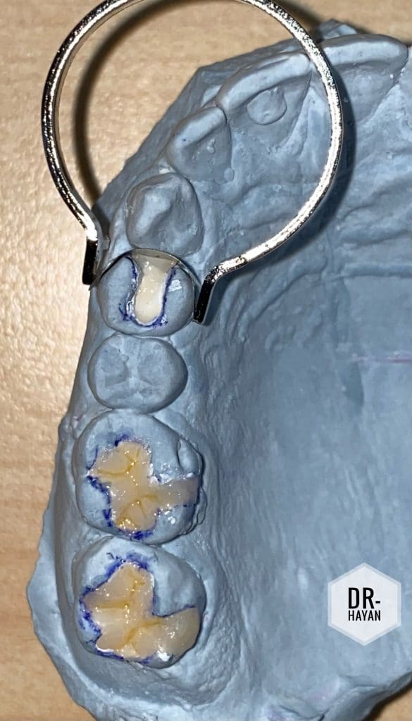 A6D8E0BE-4F0E-4C11-A329-E3E6D844555B