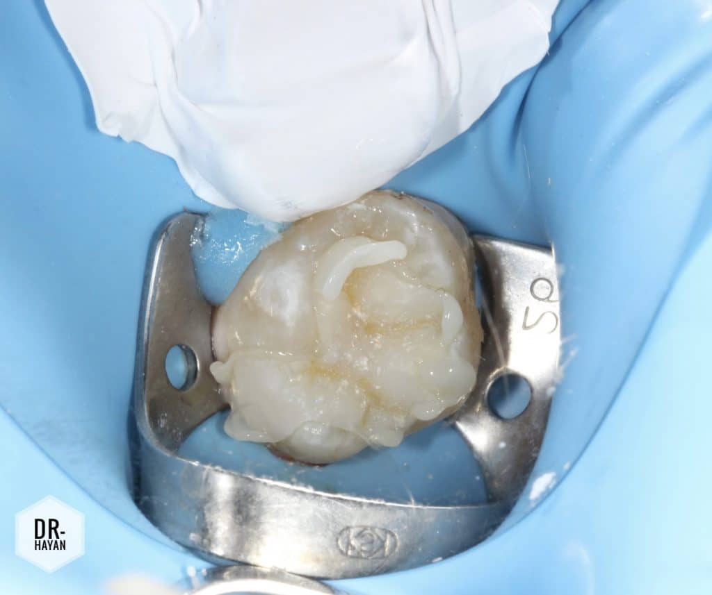 A851E94C-48CF-4FFB-B9D9-39E2B826DFAB