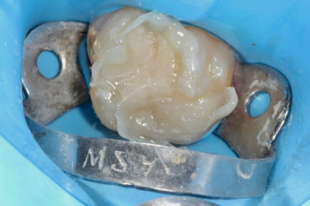 A91F4E4D-0B3C-4DDA-90B0-02F6439B24B1