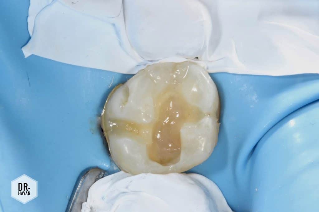 AAAAB07B-1269-4A55-B0F6-1C46D981CFBA