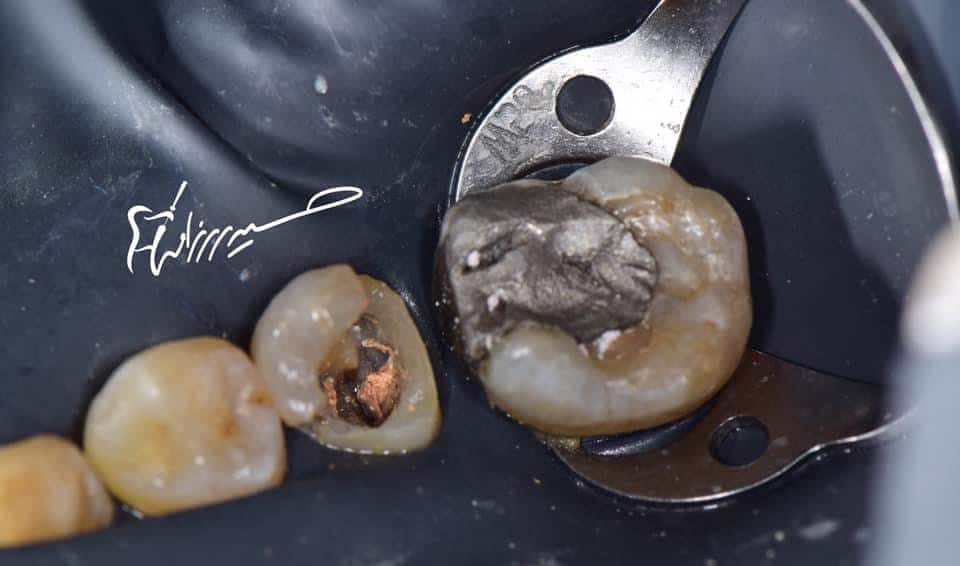 B11538E5-400F-4C35-B040-1A1577D65A55