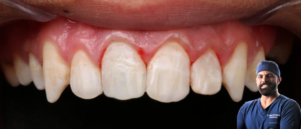 B12EFA81-6DAC-43D9-8544-BDFB513C3493