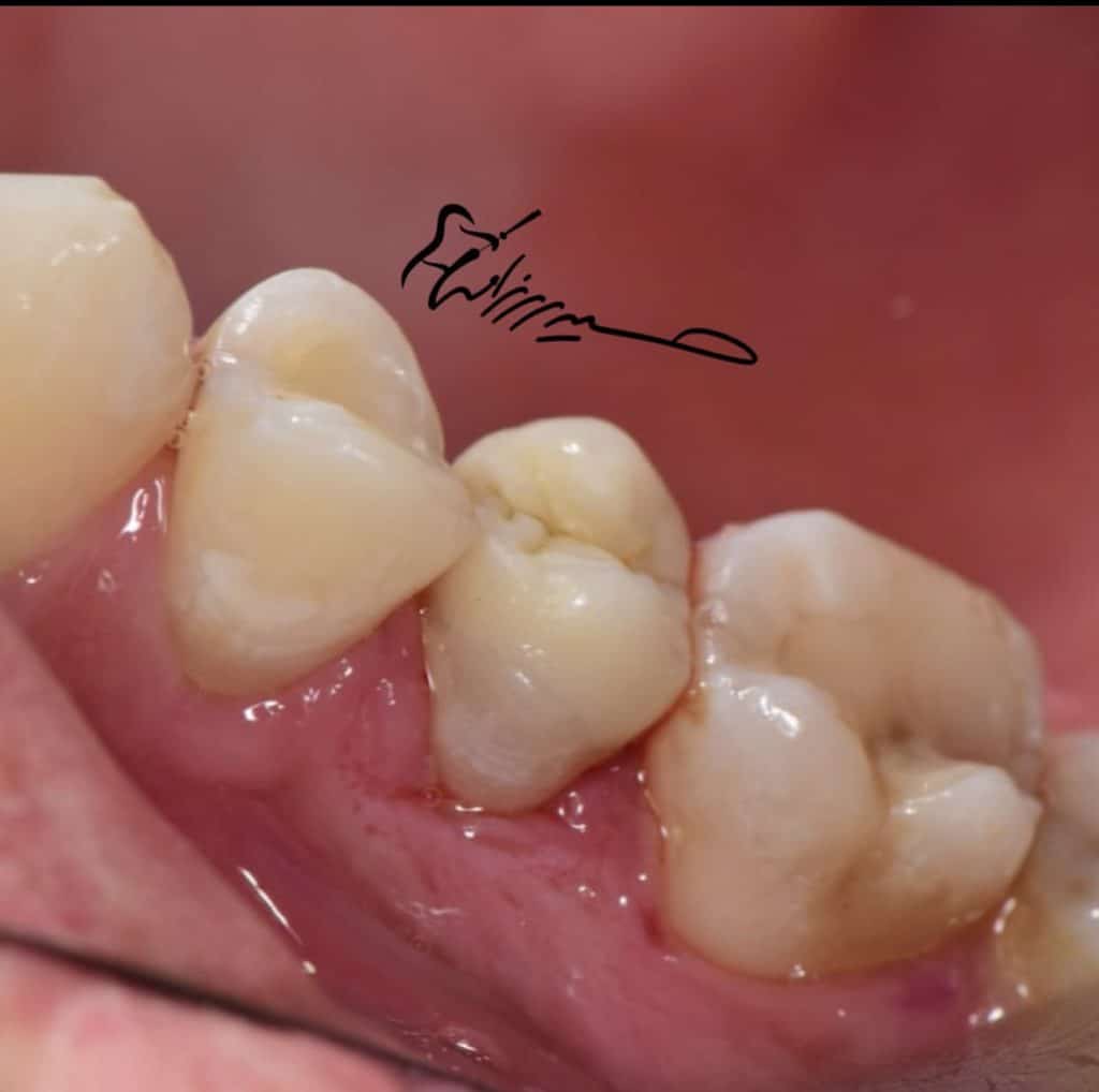 B146308D-E6D7-489E-82FC-F2DDD224CD0B