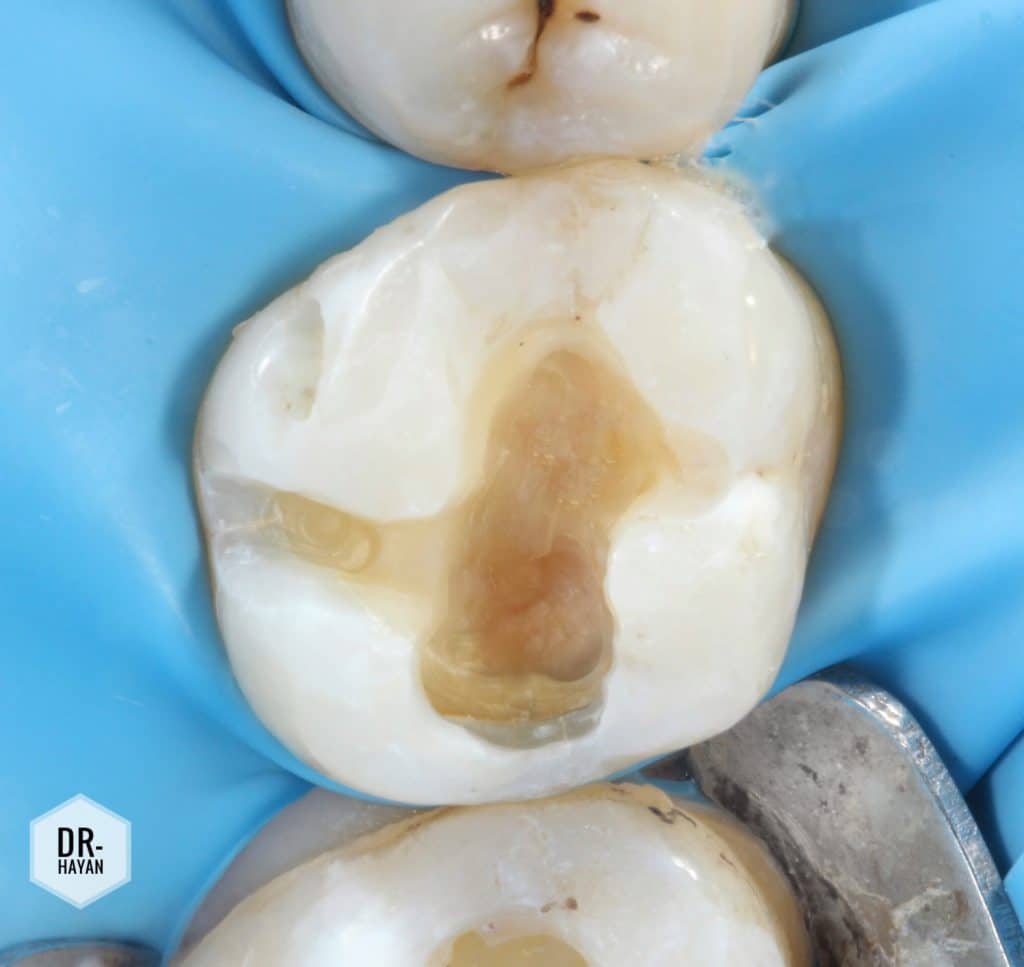 B181F5E6-3B44-46AF-A012-390A4B4BBC2A