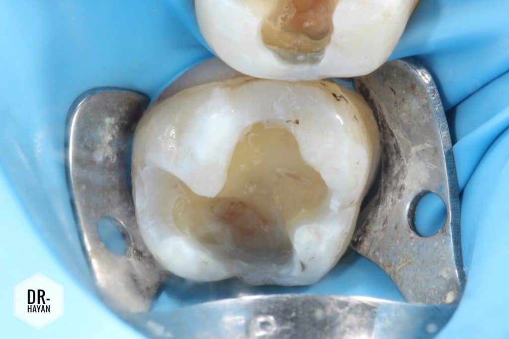 B6D86973-0E56-4AE3-8683-60FA91BC4A2D