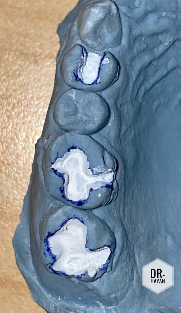 BB6C183C-3523-4D10-80C5-0D20FC357BB0