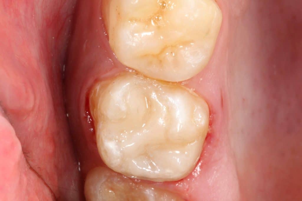 BCA22C66-70C7-44EB-8C03-2001D00DEB24