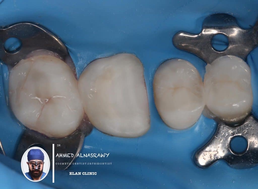 BD4E6ED8-92DC-44B5-9BB0-C6F4AF7030E8