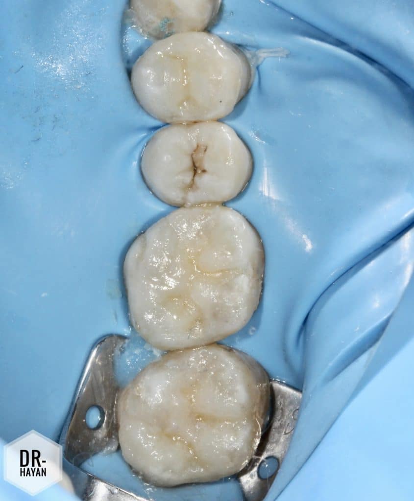 BE137E4E-DFD6-46AF-82F4-41832E7FBB40