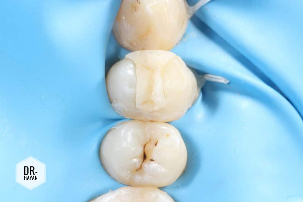 C28B252A-5061-4FD3-A056-D5621C20624F